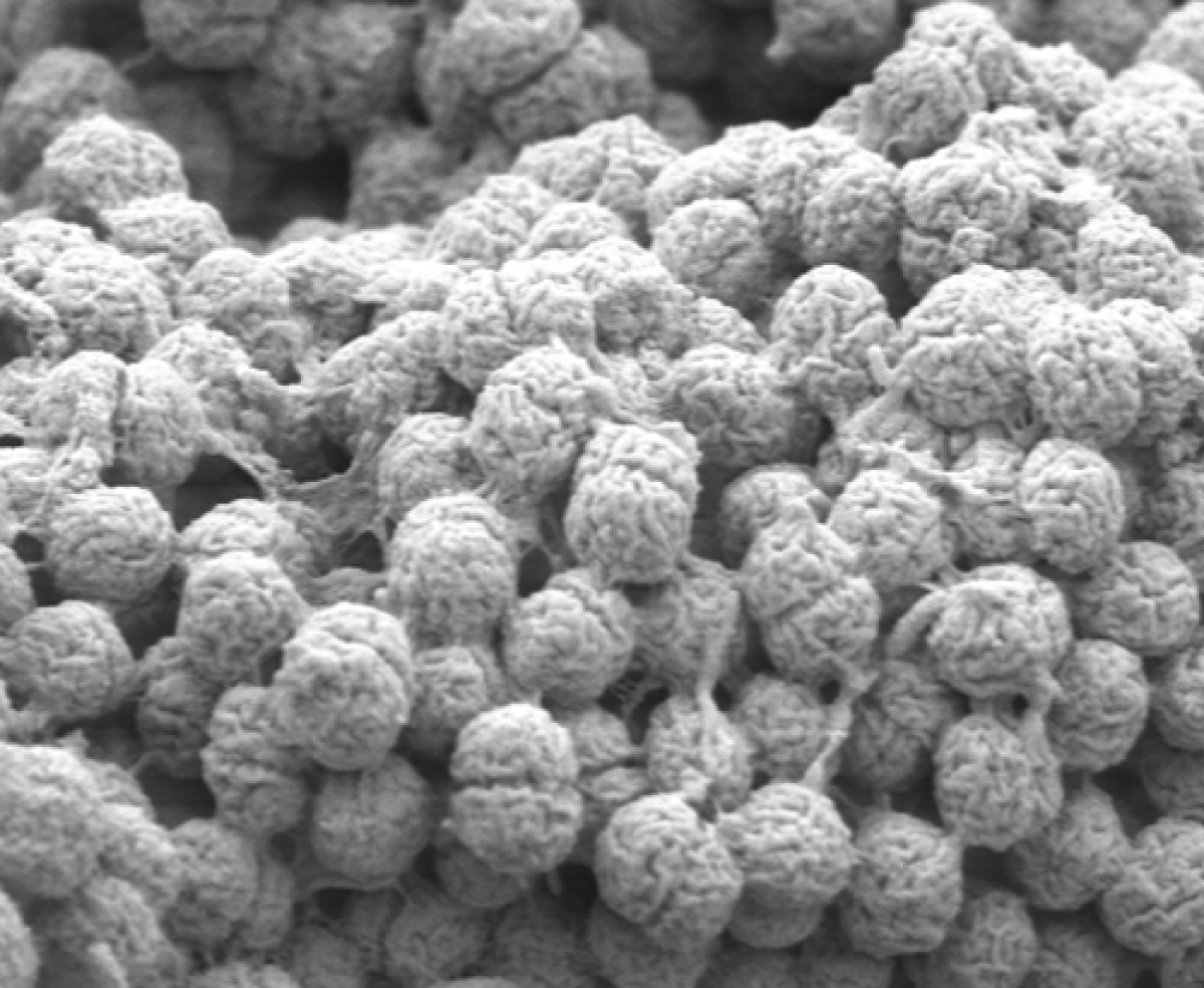 algae_in_scanning_electron_microscope_magnification