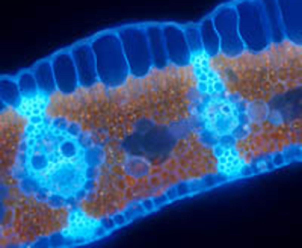 Osservando l'interno di una foglia di “falso papiro” (Cyperus alternifolius) è facile notare che le cellule possono avere diverse forme e dimensioni